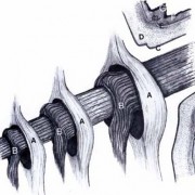 Alex Shigo: Baumschnitt, Abb. S. 157